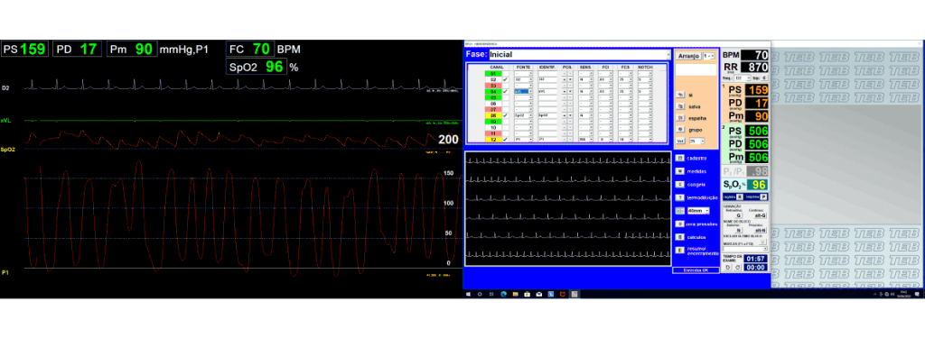 Sala de Cirurgia Integrada
