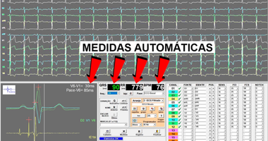 Medidas Automáticas